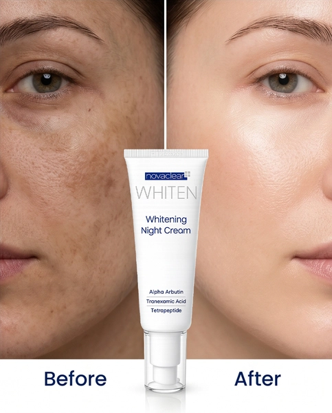 Novaclear Whiten Whitening Night Cream - Image 3